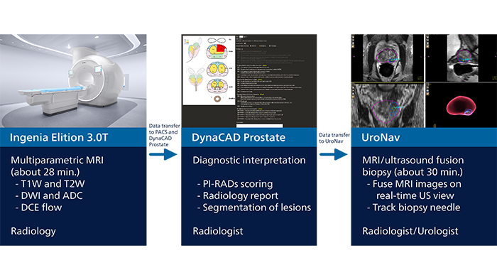 Flow chart showing workflow for MRI and MRI/ultrasound fusion biopsy for prostate cancer