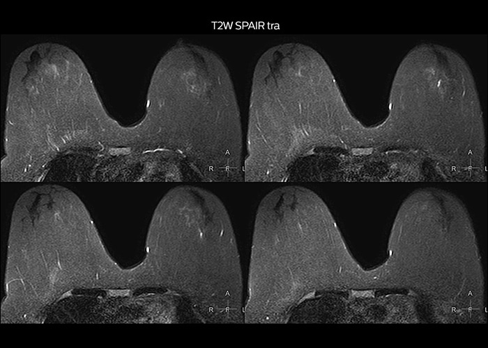 clinical cases tab3 image