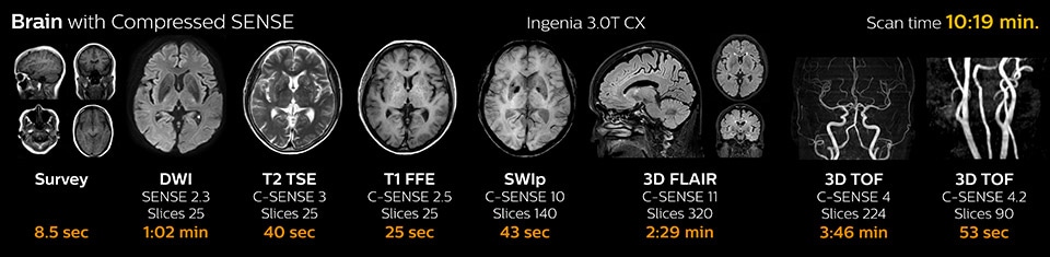 Brain with Compressed SENSE