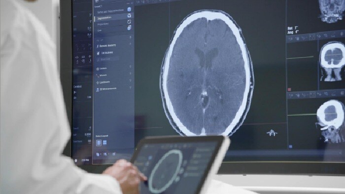 Direct To Angio Suite Philips Healthcare