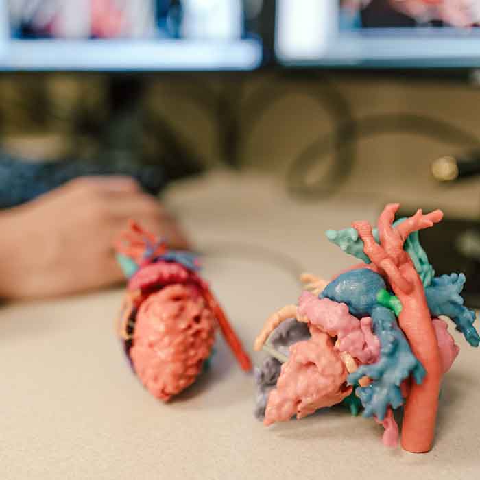 Phoenix Cardiac 3D Print Lab