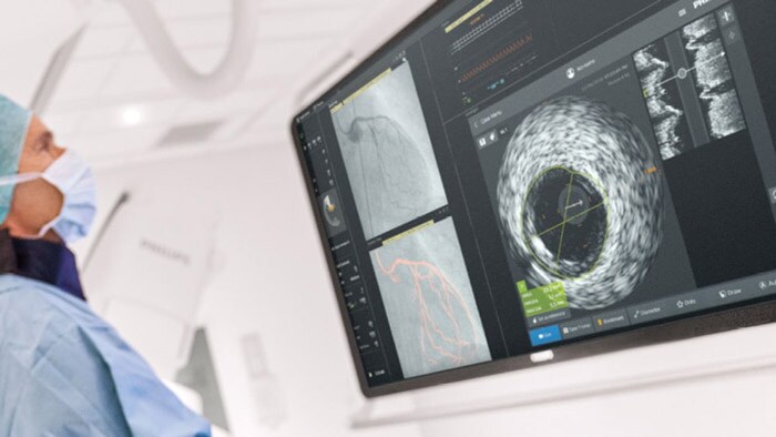 IVUS co registration