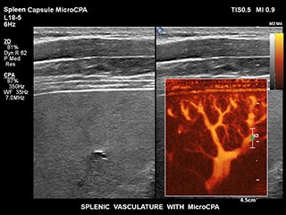 Spleen Capsule MCPA